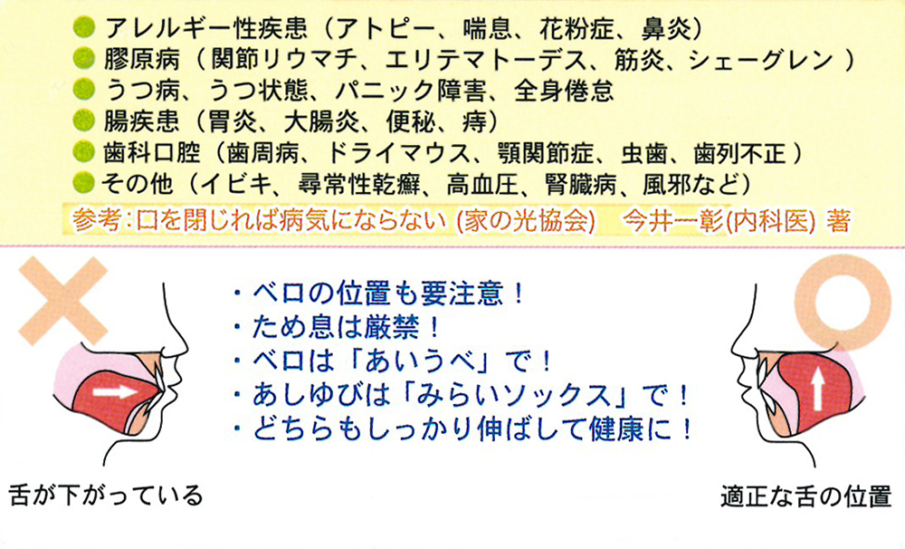 免疫を高めて病気を治す口の体操 あいうべ リウマチ アトピー 腫瘍性大腸炎にも効いた 山口県下関市の歯医者さん 加藤歯科医院