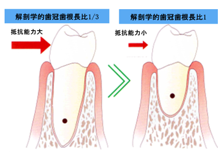 歯根の長さ