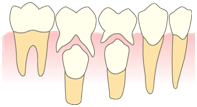 乳歯と歯並び