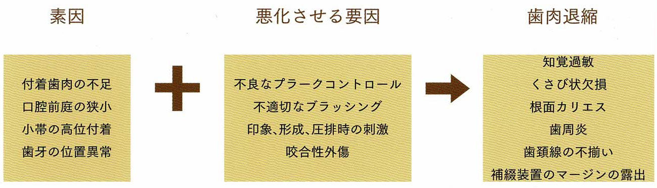 歯肉退縮の原因