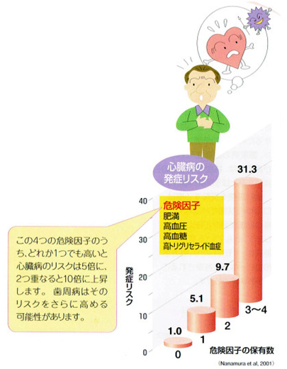 歯周病と心臓病の関係について教えてください。図