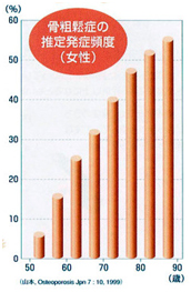 骨粗鬆症と歯周病の関係について教えてください。図