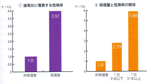 喫煙していると歯周病にかかりやすい