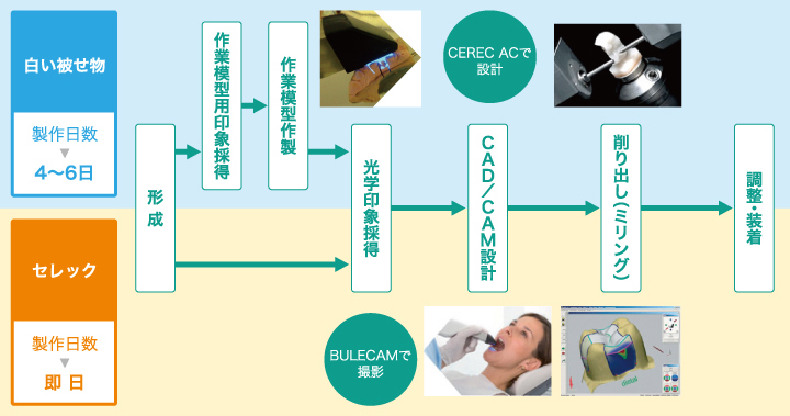 セレックが入るまで ～白い被せ物との違い～