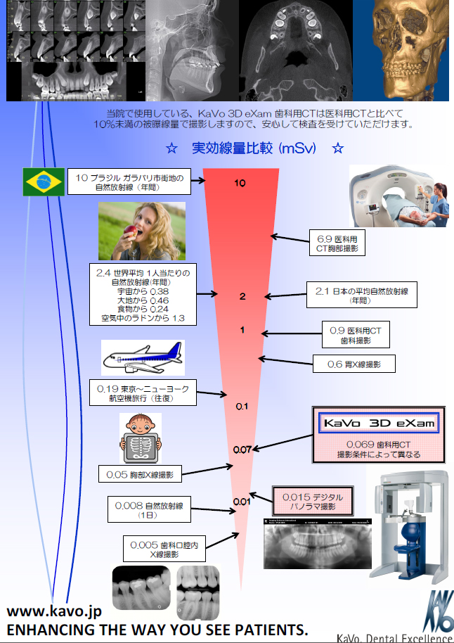 X線撮影CT機器「Kavo 3D eXam」とデジタル化