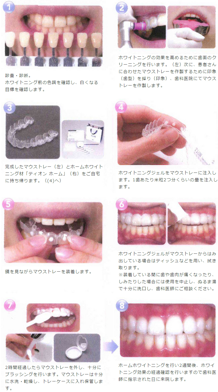 ホームホワイトニングのステップ