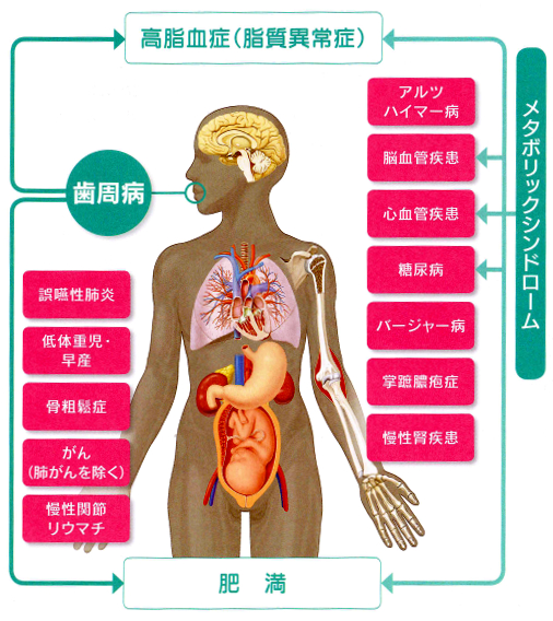 歯周病と全身疾患