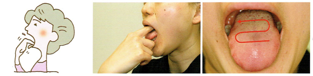 唾液腺・口腔粘膜マッサージ1-4