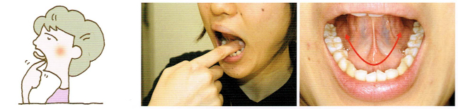 唾液腺・口腔粘膜マッサージ1-6
