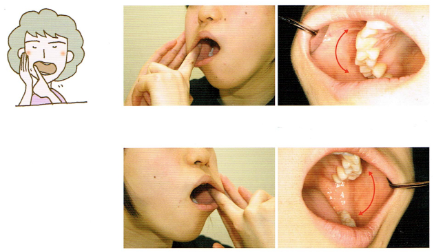 唾液腺・口腔粘膜マッサージ2