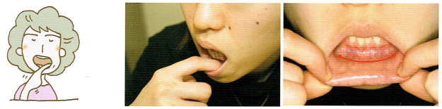 唾液腺・口腔粘膜マッサージ3-2