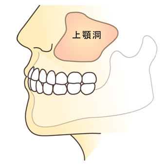 顎の骨に厚みがある正常な状態