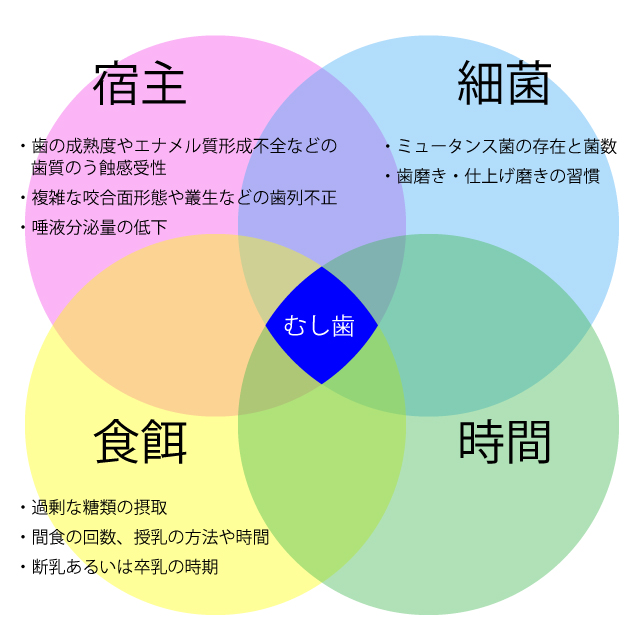 むし歯が発生する4つの要因