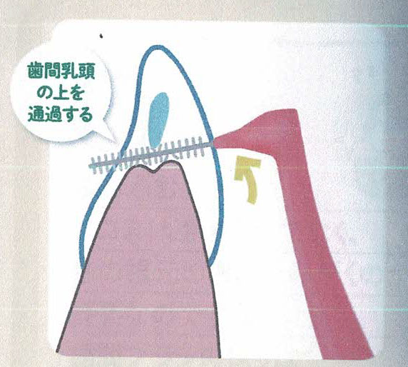 歯間ブラシの動かし方　その３