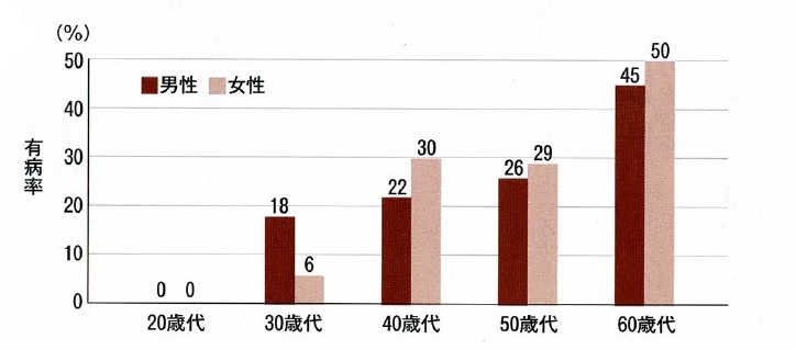 大人むし歯の有病率（歯肉退縮がある者での割合）