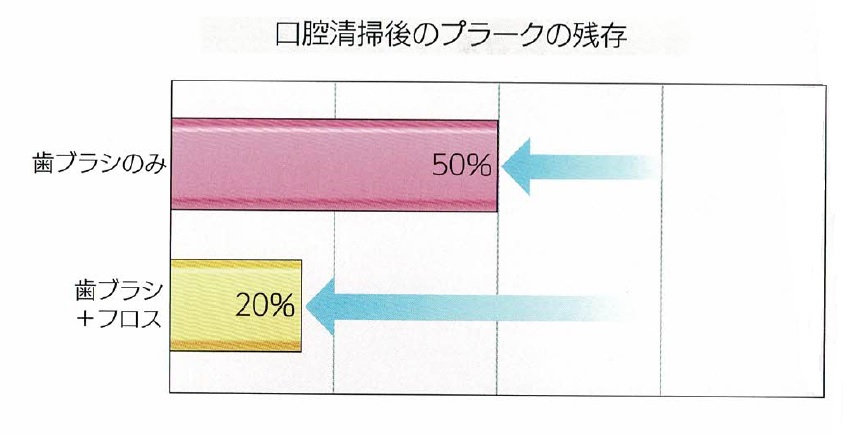 口腔清掃後のプラークの残存